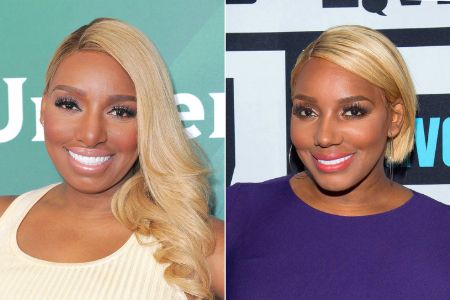 A before and after plastic surgery picture of NeNe Leakes.